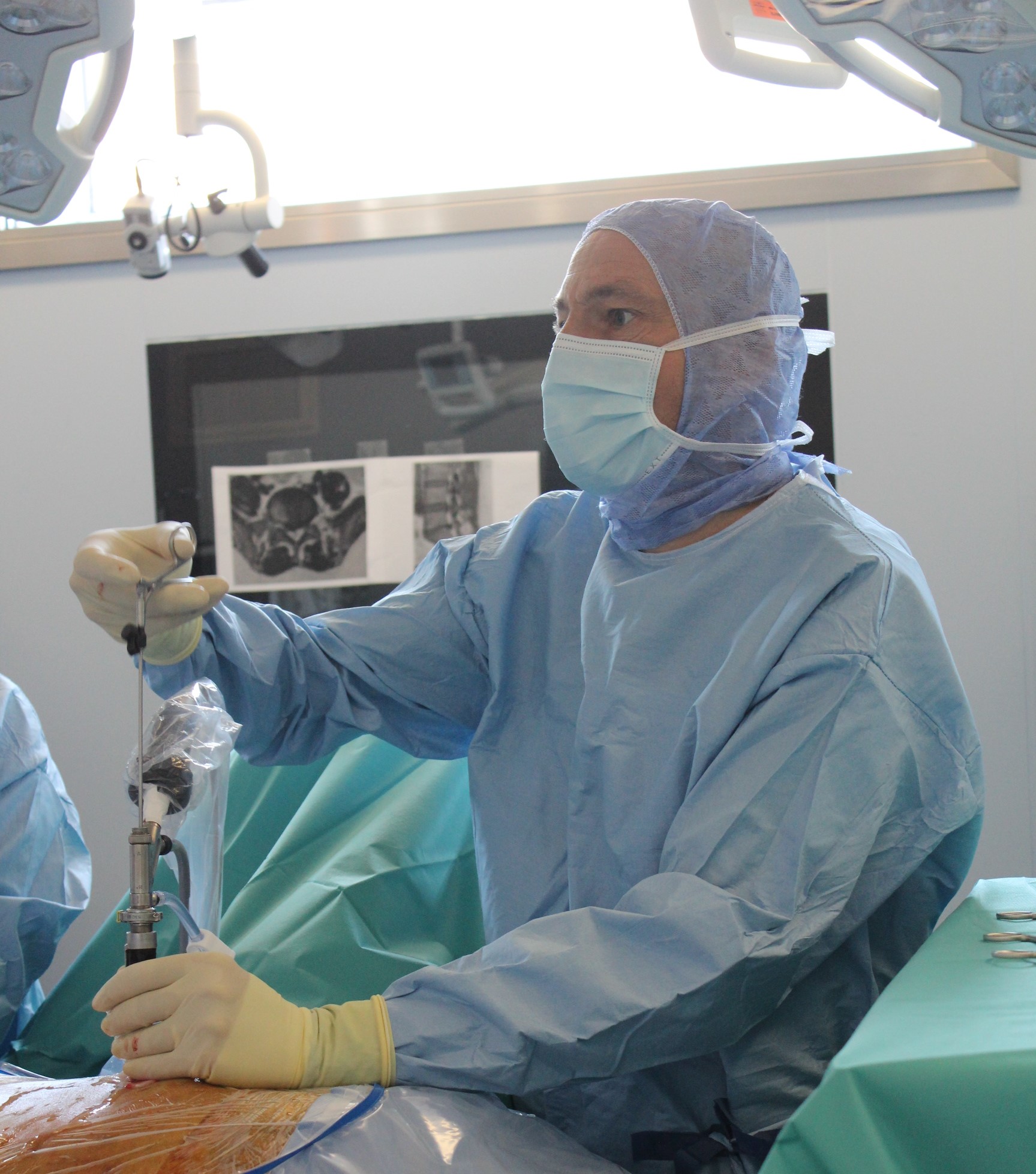 Chirurgie rachidienne par technique arthroscopique à l’AP-HP :