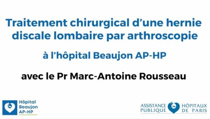 Vidéo - Chirurgie rachidienne par technique arthroscopique à l’AP-HP